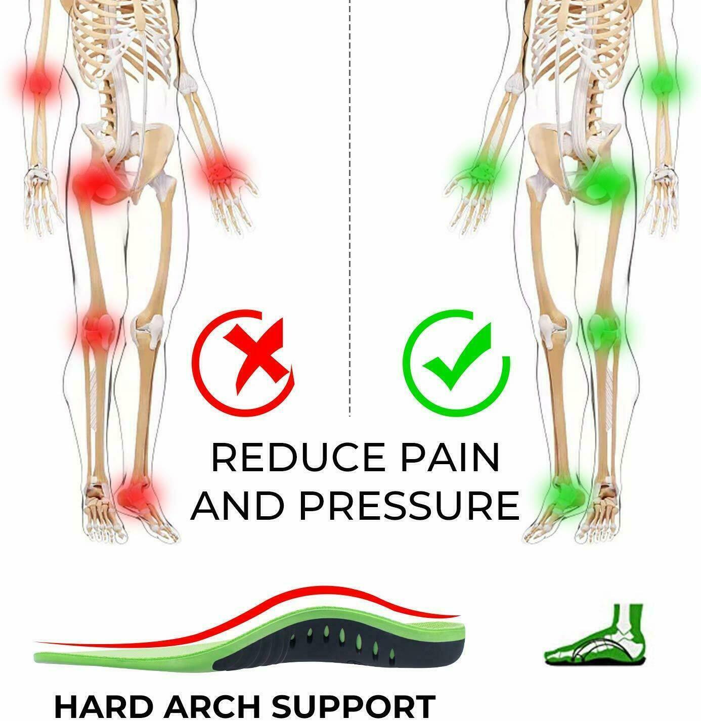 Orthotic Insoles for Flat Feet & High Arch Support